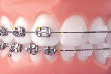 orthodontics in coimbatore