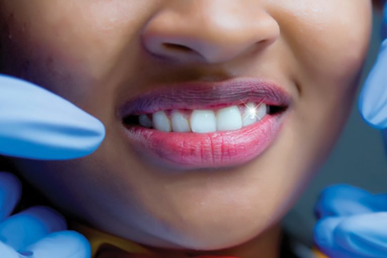 Dental Jewellery